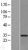 CTDSP2 Human Over-expression Lysates NM_005730