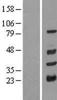 TRIM10 Human Over-expression Lysates NM_052828