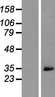 ls010109 arpc2 human over expression lysates nm 152862 wb testing 1