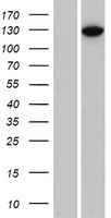 HIPK3 Human Over-expression Lysates NM_005734