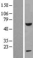 FEM 1B (FEM1B) Human Over-expression Lysates NM_015322