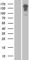 ENAM Human Over-expression Lysates NM_031889