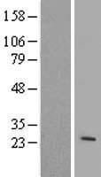 ARL4 (ARL4A) Human Over-expression Lysates NM_212460
