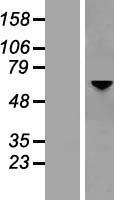 Optineurin (OPTN) Human Over-expression Lysates NM_001008212