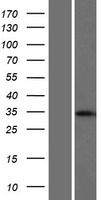 BAP31 (BCAP31) Human Over-expression Lysates NM_001139457