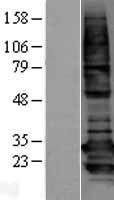 BAP31 (BCAP31) Human Over-expression Lysates NM_005745