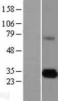Elastase 3A (CELA3A) Human Over-expression Lysates NM_005747