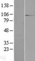 RBM12 Human Over-expression Lysates NM_006047