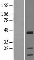 TOB (TOB1) Human Over-expression Lysates NM_005749