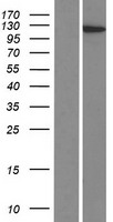 SFRS14 (SUGP2) Human Over-expression Lysates NM_001017392