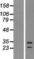 EBI3 Human Over-expression Lysates NM_005755