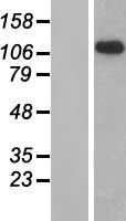 GPR64 (ADGRG2) Human Over-expression Lysates NM_001079859