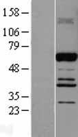 ls010152 abi2 human over expression lysates nm 005759 wb testing 1