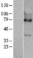 LPCAT3 Human Over-expression Lysates NM_005768