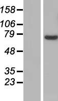 SLC25A13 Human Over-expression Lysates NM_014251