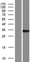 ZNF197 Human Over-expression Lysates NM_001024855