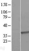 DHRS9 Human Over-expression Lysates NM_199204