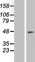 RNA terminal phosphate cyclase like 1 (RCL1) Human Over-expression Lysates NM_005772