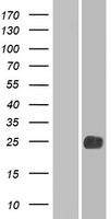 LHFPL2 Human Over-expression Lysates NM_005779