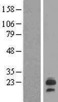 LHFPL6 Human Over-expression Lysates NM_005780