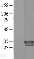 Thioredoxin domain containing 9 (TXNDC9) Human Over-expression Lysates NM_005783