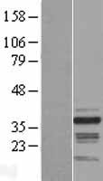 RNF41 Human Over-expression Lysates NM_194358