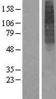 ALG3 Human Over-expression Lysates NM_005787