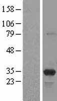 PSME3 Human Over-expression Lysates NM_005789