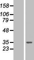 PSME3 Human Over-expression Lysates NM_176863