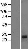 DHRS2 Human Over-expression Lysates NM_182908