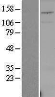 ls010208 uspl1 human over expression lysates nm 005800 wb testing 1