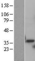 PSMD14 Human Over-expression Lysates NM_005805