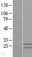 SSX3 Human Over-expression Lysates NM_021014
