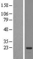 SSX3 Human Over-expression Lysates NM_175711