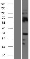 OLIG2 Human Over-expression Lysates NM_005806