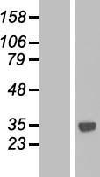 CTDSPL Human Over-expression Lysates NM_001008392