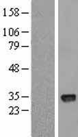 CTDSPL Human Over-expression Lysates NM_005808