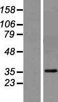 GPA33 Human Over-expression Lysates NM_005814