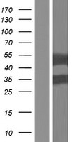 Perilipin 3 (PLIN3) Human Over-expression Lysates NM_001164194