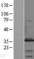 Syntaxin 6 (STX6) Human Over-expression Lysates NM_005819
