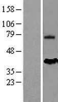 Mesothelin (MSLN) Human Over-expression Lysates NM_005823
