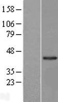 LRRC23 Human Over-expression Lysates NM_001135217