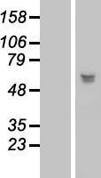 LRRC17 Human Over-expression Lysates NM_001031692