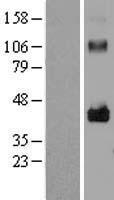 LRRC17 Human Over-expression Lysates NM_005824