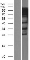 hnRNP R (HNRNPR) Human Over-expression Lysates NM_005826