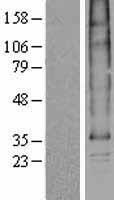 ls010237 slc35b1 human over expression lysates nm 005827 wb testing 1