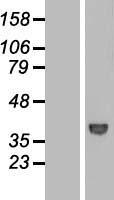 WDR68 (DCAF7) Human Over-expression Lysates NM_005828