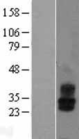 KCNMB2 Human Over-expression Lysates NM_005832