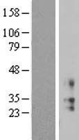 KCNMB2 Human Over-expression Lysates NM_181361