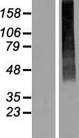 SLC17A2 Human Over-expression Lysates NM_005835